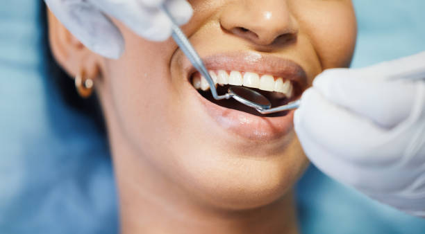 Best Broken or Cracked Tooth Emergency Dentist in Marengo, IL