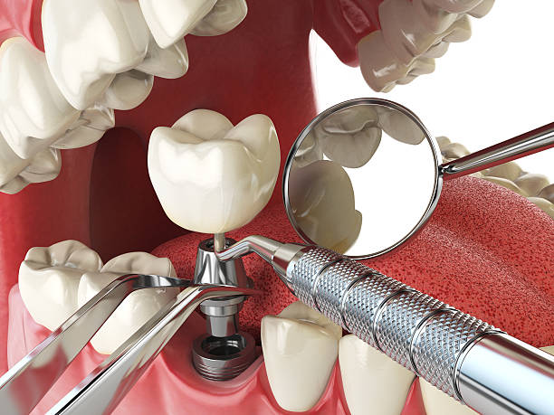 Best Emergency Dental Services for Seniors in Marengo, IL